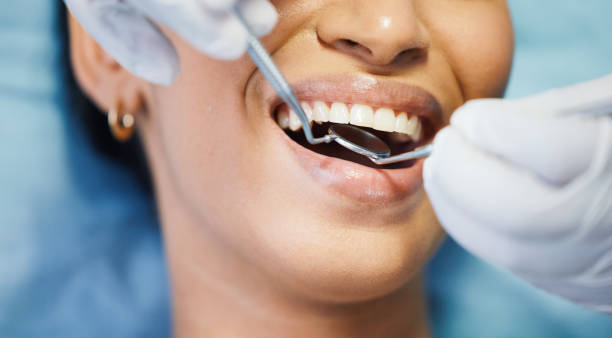 Best Emergency Dental Care for Broken or Chipped Teeth in Fussels Corner, FL